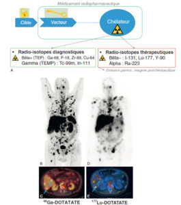 Figure 16.1 Illustration du concept de « théranostique ». A. Concept général (cible, vecteur, chélateur, isotope). B-C. Validation de l'expression des cibles. Imagerie TEP-TDM à l'aide du 68Ga-DOTATOC (analogue des récepteurs à la somatostatine). L'examen montre une hyperfixation intense en regard de multiples lésions métastatiques majoritairement osseuses, mais également hépatiques (flèches bleues) et ganglionnaires (flèche rouge) visibles sur l'image corps entier (projection d'intensité maximale, B) et une coupe axiale au niveau hépatique (C). Ces images attestent d'une forte surexpression des récepteurs à la somatostatine. Ce critère validé, le patient a reçu une injection de Lu-177-DOTATATE thérapeutique. D, E. Imagerie post-thérapeutique. Ces images (projection d'intensité maximale vue antérieure en D, et coupe axiale TEMP-TDM en E) réalisées 24 heures après l'injection de 7,4 GBq de 177Lu-DOTATATE confirment la bonne captation du médicament radiopharmaceutique thérapeutique par les différentes cibles tumorales.