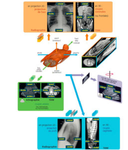 Figure 2.8 Orientation conventionnelle des images : coupes axiales, coronales et sagittales de TDM ; projections de face et profil en radiographie. L'orientation est normalisée pour ces différentes images. Elle est la même en IRM et en tomoscintigraphie. Les coupes sagittales d'échographie sont représentées différemment, le pôle crânial étant placé à gauche de l'écran. Dessin : Emmanuel Durand.