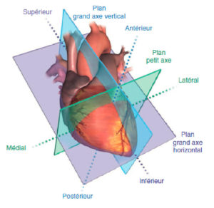 Figure 26.1 Orientation des trois principaux plans de coupe utilisés en imagerie cardiaque, définis selon le grand axe du ventricule gauche (VG). VD : ventricule droit. Source : Mitchell C, Rahko PS, Blauwet LA, et al. Guidelines for performing a comprehensive transthoracic echocardiographic examination in adults: recommendations from the American Society of Echocardiography. J Am Soc Echocardiogr 2019 ; 32 : 1–64..