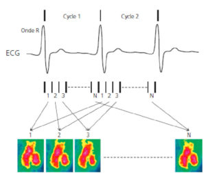 Figure 26.2 Concept d'acquisition synchronisée à l'ECG, exemple de la ventriculographie isotopique. Une série de N images de durées égales est acquise au cours de chaque cycle cardiaque. Les premières images de chaque cycle sont associées entre elles pour obtenir une première image combinée, même chose pour les secondes images, etc. jusqu'à obtention d'une série d'images combinées représentant l'évolution du signal au cours d'un cycle.