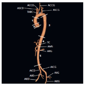 Figure 26.7 Aorte normale en angio-TDM au temps artériel avec reconstruction tridimensionnelle de type rendu volumique. Segment 0 : racine de l'aorte, de l'anneau à la jonction sinotubulaire ; segment 1 : aorte ascendante ; segment 2 : crosse de l'aorte ou arc aortique ; segment 3 : aorte thoracique descendante ; segment 4 : aorte abdominale suprarénale ; segment 5 : aorte abdominale intrarénale. ACCD : artère carotide commune droite ; ACCG : artère carotide commune gauche ; AICD : artère iliaque commune droite ; AICG : artère iliaque commune gauche ; AIED : artère iliaque externe droite ; AIEG : artère iliaque externe gauche ; AIID : artère iliaque interne droite ; AIIG : artère iliaque interne gauche ; AMS : artère mésentérique supérieure ; ARG : artère rénale gauche (sous cette incidence, l'artère rénale droite n'est pas visible) ; ASCD : artère subclavière droite ; ASCG : artère subclavière gauche ; TABC : tronc artériel brachiocéphalique ; TC : tronc cœliaque.