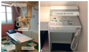 Figure 3.1 Principaux composants d'une installation permettant la réalisation de radiographies standard (A, B).