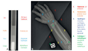 Figure 3.6 Les différentes atténuations en radiographie. A. Un tube à essai contenant de la craie, de l'eau, de l'huile et de l'air a été radiographié pour illustrer les quatre atténuations correspondantes en radiographie : calcique, hydrique, graisseuse et aérique. B. Exemple des quatre atténuations visibles sur la radiographie d'avant-bras et de main d'un enfant de 2 ans. Les muscles, les cartilages, les capsules et les ligaments ont la même atténuation, celle de l'eau, ce qui ne permet pas de les distinguer les uns des autres en radiographie.