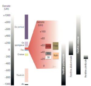 Figure 4.2 Échelle de Hounsfield. Représentation schématique de la répartition des densités rencontrées dans l'organisme sur l'échelle de densité arbitraire utilisée en pratique. Les densités TDM sont exprimées en UH. Les densités correspondant aux parties molles et organes pleins sont très proches les unes des autres si l'on considère toute l'amplitude de l'échelle (de –1000 à + 1000 UH). L'utilisation de fenêtres, représentées à droite, permet de ne se concentrer que sur une plage donnée de l'échelle afin d'accentuer le contraste et de rendre perceptibles par l'œil humain ces faibles différences de densité. Les pixels situés en dessous de la borne inférieure de la fenêtre apparaissent tous en noir tandis que ceux situés au-dessus de la borne supérieure apparaissent tous en blanc. SB : substance blanche ; SG : substance grise.