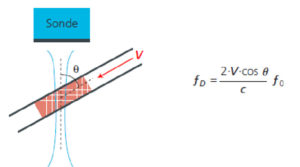 Figure 7.11 Schéma de fonctionnement du mode Doppler continu. Une sonde engendre un faisceau ultrasonore dessiné en bleu qui croise un vaisseau sanguin sous l'angle θ. La vitesse de circulation est indiquée par le vecteur V.