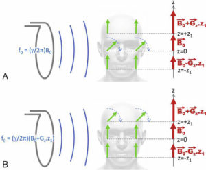 Figure 8.10 Principe de la sélection de coupe en IRM. L'application simultanée d'un gradient de champ Gz et d'une excitation RF permet d'exciter sélectivement un plan situé à z = 0 (A) ou z = z1 (B) selon la fréquence d'excitation utilisée.