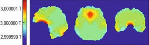 Figure 8.13 Inhomogénéités du champ magnétique B0 dans un cerveau humain chez un sujet placé dans une IRM à 3 T. Au voisinage des cavités aériques de la tête, B0 s'éloigne de la valeur de 3 T ; même très faibles, ces inhomogénéités peuvent causer des artefacts importants sur les images. Source : N. Boulant, CEA/NeuroSpin.