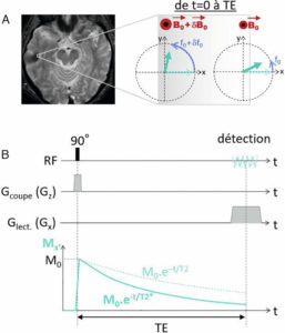 Figure 8.14 Évolution temporelle de l'aimantation transversale dans un voxel où B0 est inhomogène. Les aimantations de ce voxel sont soumises à des champ magnétiques de valeurs différentes et précessent donc à des fréquences différentes (A) ; l'aimantation détectée à l'échelle du voxel étant la somme vectorielle de toutes les aimantations, elle est d'autant plus atténuée que les aimantations sont déphasées ; l'effet des déphasages s'ajoute à la relaxation en T2 et accélère la disparition de la composante transversale Mx′ qui décroît en T2* (B).