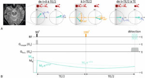 Figure 8.15 Principe de l'écho de spin. Pendant la 1re moitié de la séquence, les aimantations du voxel se déphasent sous l'effet de l'inhomogénéité de B0 (A) ; à t = TE/2, on applique une impulsion RF de 180° qui inverse la phase des aimantations. Pendant la 2e moitié de la séquence, les aimantations du voxel se rephasent ; l'aimantation globale du voxel décroît en T2* pendant la 1re moitié de la séquence (B), puis retrouve une valeur correspondant à la décroissance en T2 au moment de la détection.
