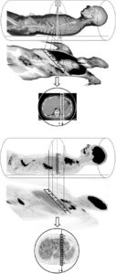 Figure 9.3 Projections et reconstructions en tomodensitométrie et en tomoscintigraphie. Dessin : Denis Mariano-Goulart.