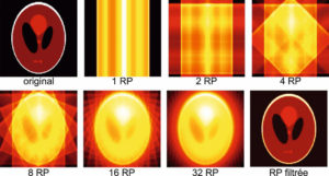 Figure 9.7 Rétroprojection. À partir d'une image originale (simplifiée) dont on a déterminé les projections dans diverses directions, on construit les rétroprojections avec un nombre de projections allant de 1 à 32 ; on voit alors se dessiner progressivement une représentation imparfaite de l'image originale. Seule une opération de filtrage permettra de retrouver une représentation fidèle de l'image originale. Dessin : Emmanuel Durand.