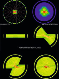 Figure 9.8 Illustration des opérations de projection, de rétroprojection et de rétroprojection filtrée dans le cas d'une tomoscintigraphie cérébrale. Dessin : Denis Mariano-Goulart.